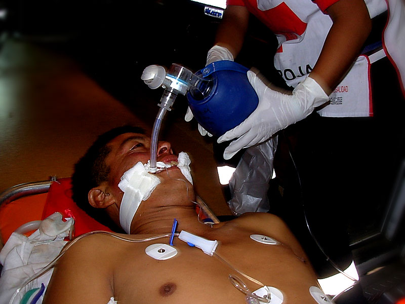 Emeterio Marino Cruz, algunos días después de la golpiza © Difusión Emeterio Marino Cruz