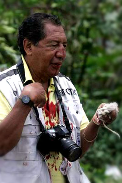 An injured journalist © Oaxaca en Pie de Lucha